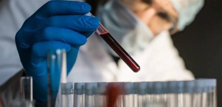 فحص-بسيط-مدعوم-بالذكاء-الاصطناعي-يكشف-90%-من-سرطانات-القولون-والمستقيم